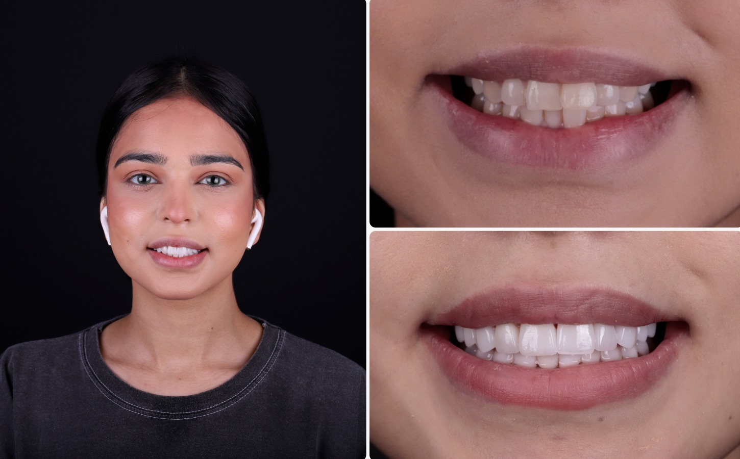 before & After images