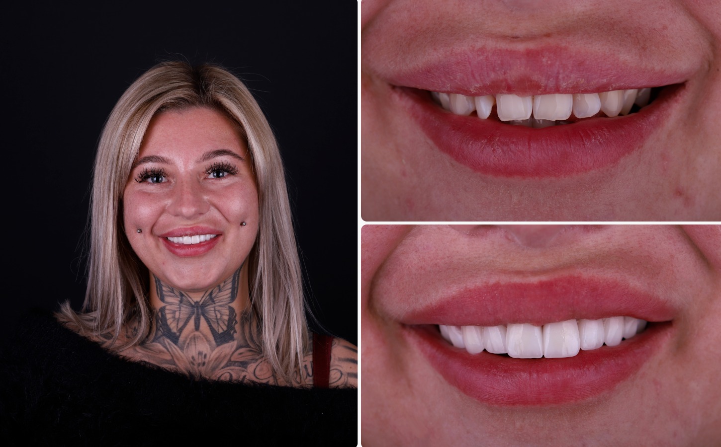 before & After images
