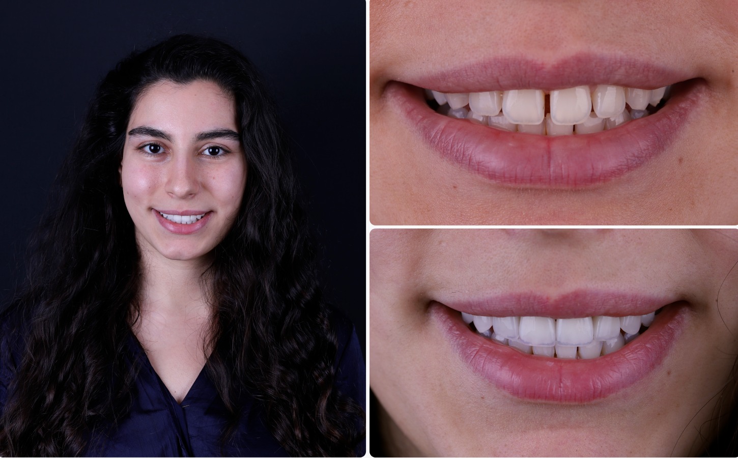 before & After images